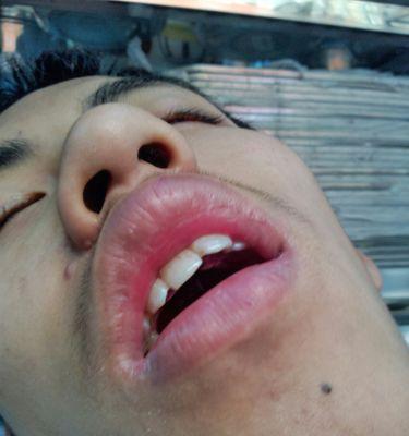 DB2物化视图——MQT 物化查询表的正确使用